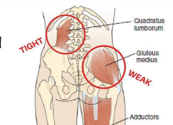 Glute medius and quadratus lumborum muscles