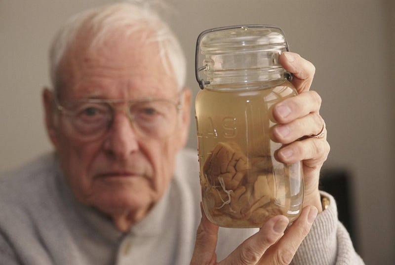 Dr. Harvey holding sections of Einstein's brain